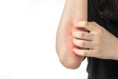 ​止痒消炎水 老年人皮肤总是瘙痒千万别乱挠，做好这几点，能够有效缓解